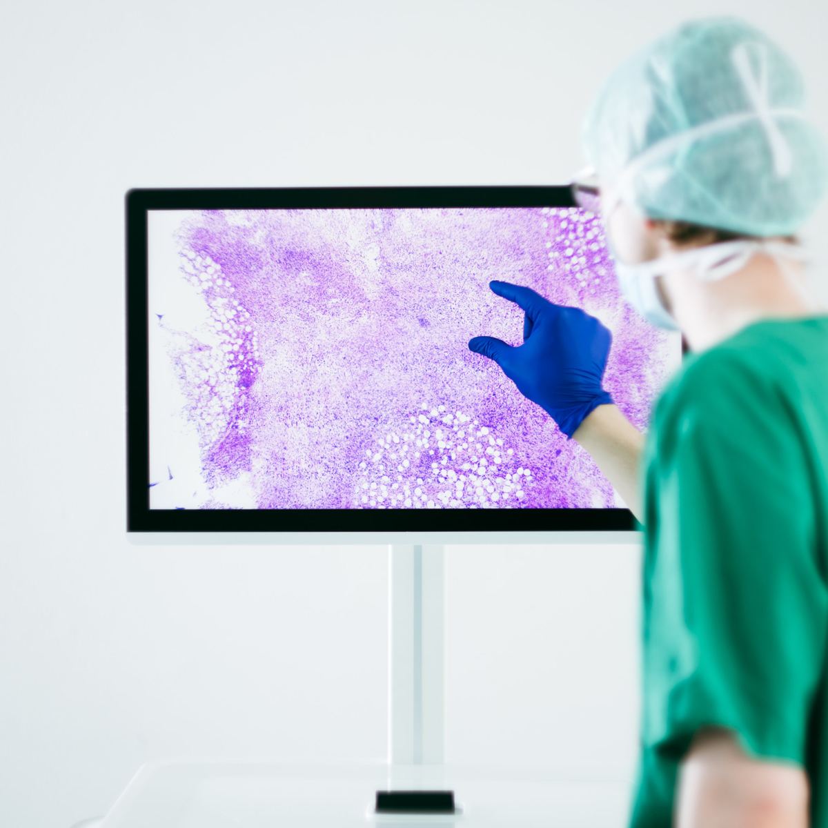 A clinician using the Histolution imaging device and viewing a violet digital histology image on its screen.