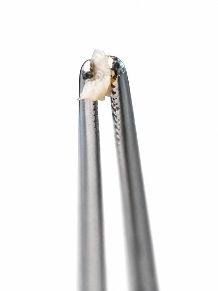 Fresh tissue held by laboratory tweezers